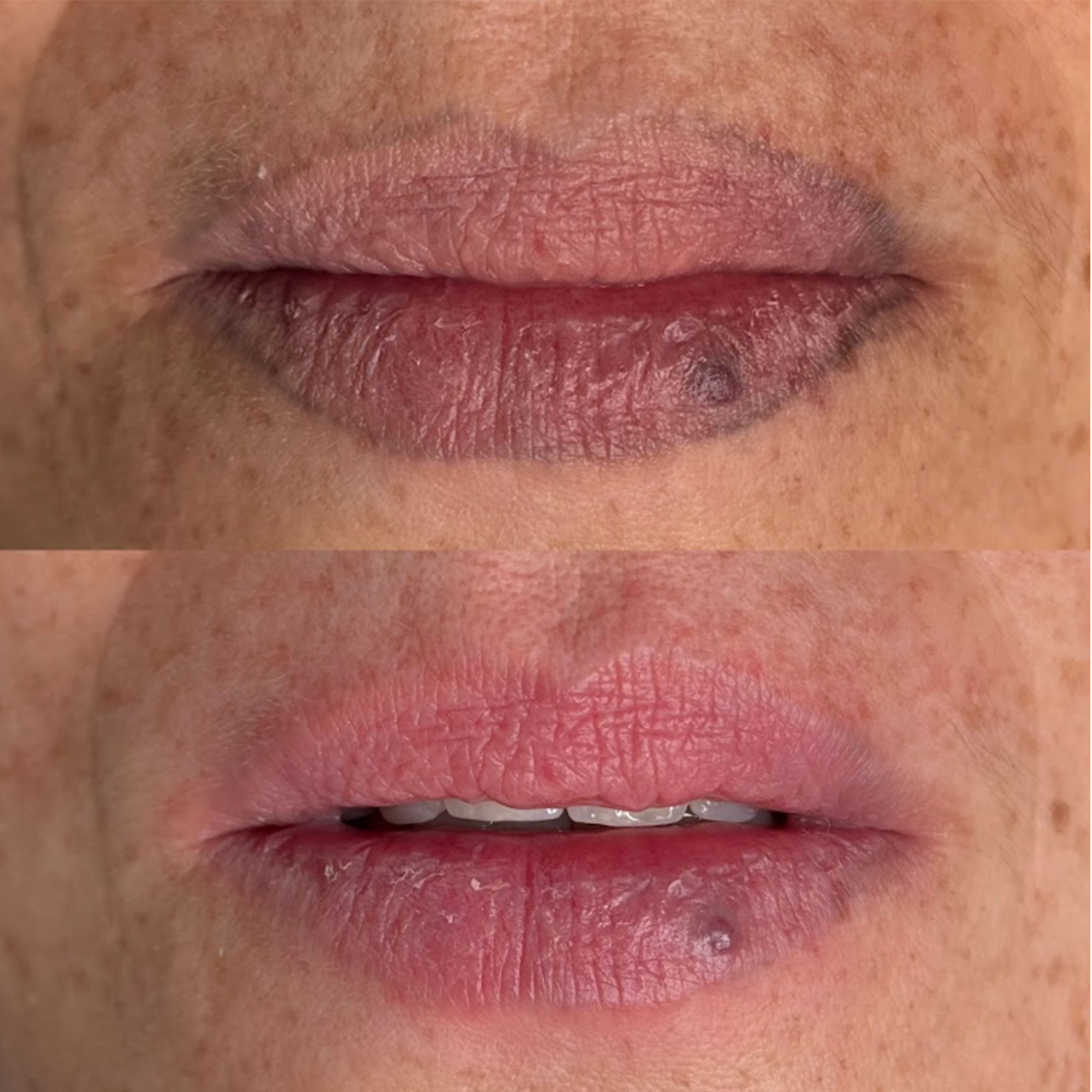 Correción de pgimentos en labios en Madrid - Sophie Lin Beauty